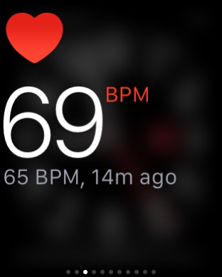 Apple Watch - heart rate