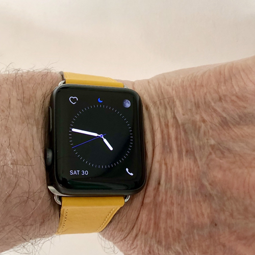 Canary Yellow Band