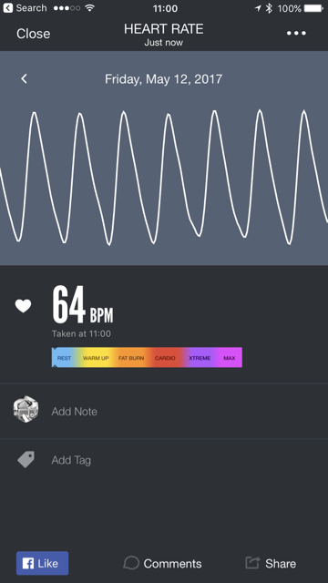 Cardiogram