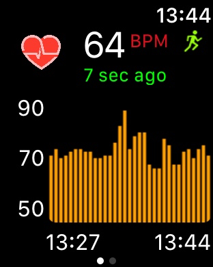 Cardiogram