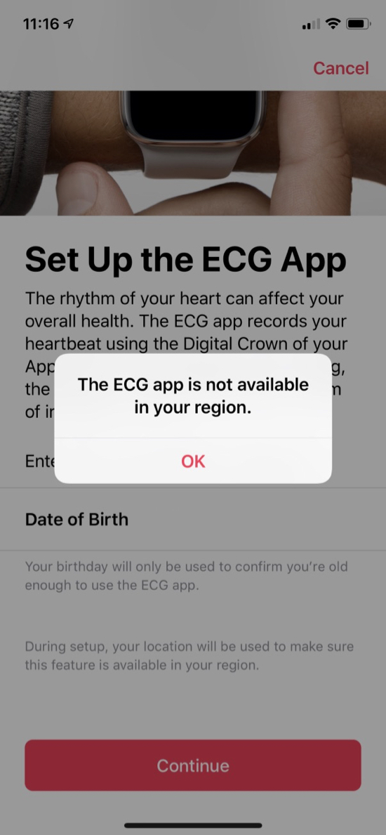 ECG setup