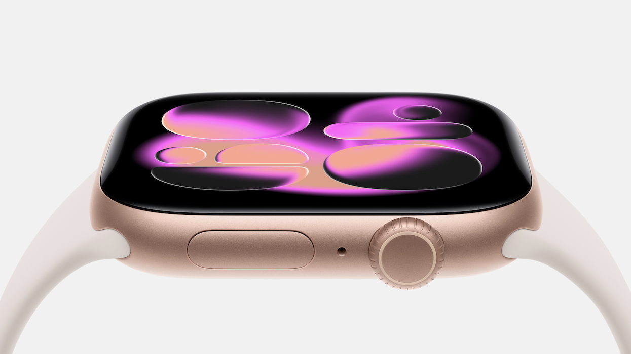 Apple Watch 11