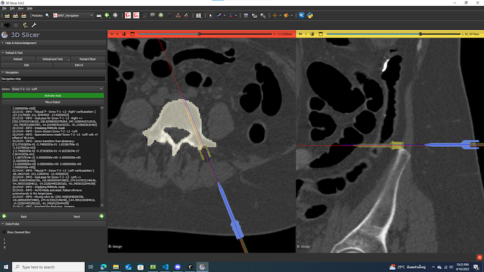CT Scan of process